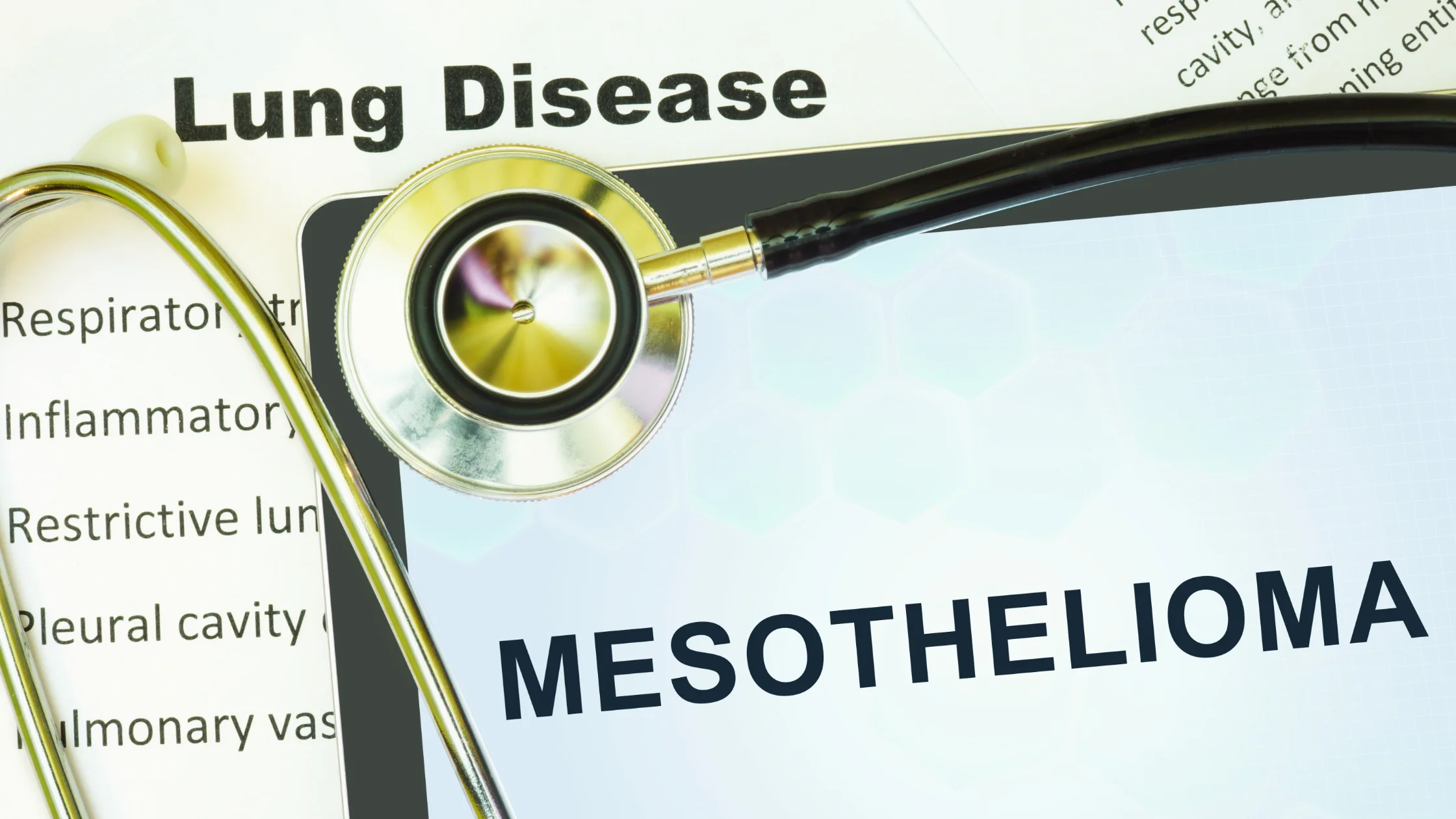 A Breakdown of Legal Rights for Mesothelioma Victims