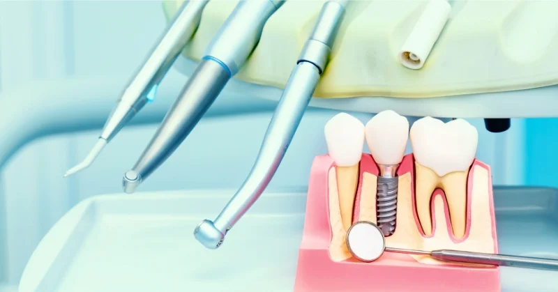 Unmatched Experience in the Dental Industry
